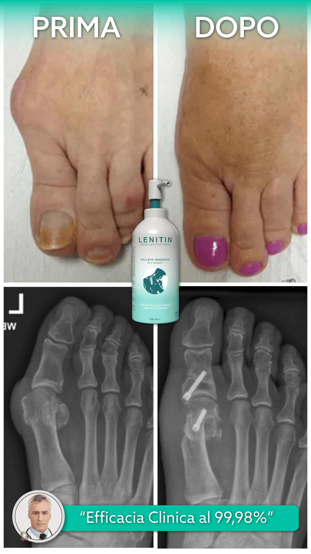 2-prima-e-dopo-clinica